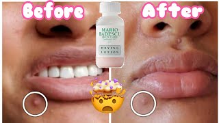 Mario Badescu Drying Lotion First Impressions and Review [upl. by Suki]