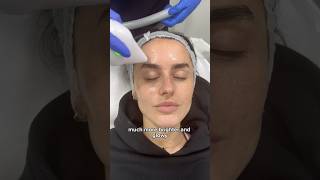 Amber Davies 4th Session of Endymed Facial Tightening Treatment at Dr MediSpa [upl. by Llenrod621]