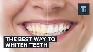 The best way to whiten teeth [upl. by Coreen]