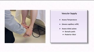 The Diabetic Foot Exam [upl. by Strage]