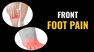 Front Foot Pain  Dr Donald Pelto  Worcester Podiatrist [upl. by Judenberg]