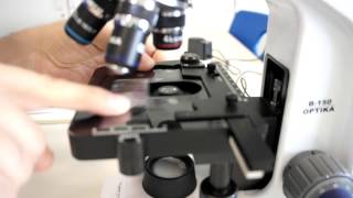 ALevel Biology Calibration of Eyepiece Graticule with stage micrometer [upl. by Ainaznat885]