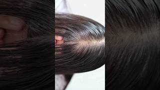 fast hair growth tips [upl. by Anyg587]