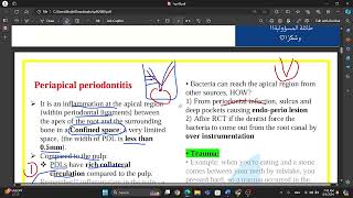 Periapical periodontitis [upl. by Norred]