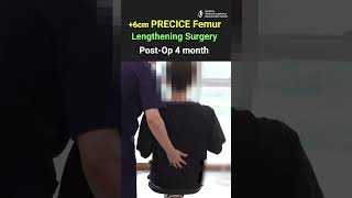 6cm PRECICE Femur [upl. by Vyse549]