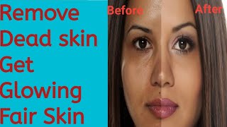 Glowing Fair Skin  Remove dead skin from face skin whitening formula beautyhealth2595 [upl. by Jenei]