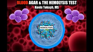 Blood Agar  The Hemolysis Test Theory amp Results [upl. by Henning114]