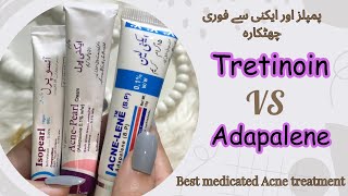 Best Acne Fighting Products  Medicated Acne Treatment  Dermatologist Recommended Creams [upl. by Pendleton]