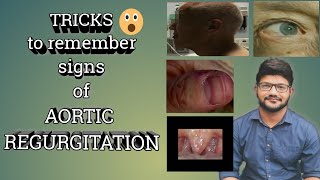 Dr Tricks Aortic Regurgitation Signs Made Easy With Tricks and Mnemonics 🔥 All Peripheral Signs [upl. by Jahncke]