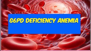 G6PD deficiency hemolytic anemia [upl. by Sanoy753]