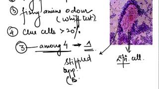 Syndromic management of STI [upl. by Franz]