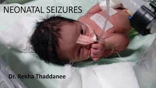 Neonatal Seizures  Pediatrics [upl. by Berglund706]