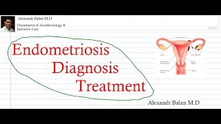 Endometriosis [upl. by Liamsi]