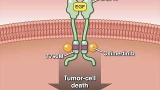 Osimertinib in Advanced Non–SmallCell Lung Cancer [upl. by Yesdnik]