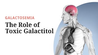 Galactosemia Pathogenesis The Role of Toxic Galactitol [upl. by Niro]