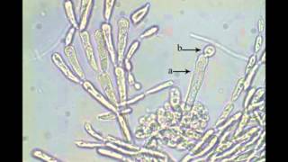 Gheens Guide to Intertidal Algae Lifecycles Chapter 1 Florideophyceae [upl. by Aisatsanna108]