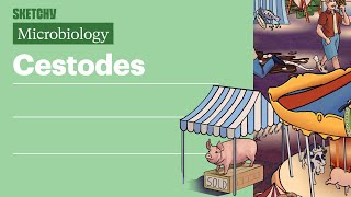 Cestodes Microbiology  USMLE Step 1  Sketchy Medical [upl. by Fisuoy]