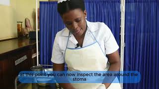 COLOSTOMY CARE By Tumusiime Anita [upl. by Dnomsad]