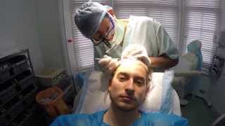 Hair Transplant Diary  Episode 1 Part 1 [upl. by Jenni22]