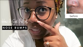 HOW TO GET RID OF A NOSE PIERCING BUMP KELOID FAST  hellotinashe [upl. by Gundry]