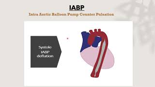 Cardiac ssist device IABP [upl. by Boor]