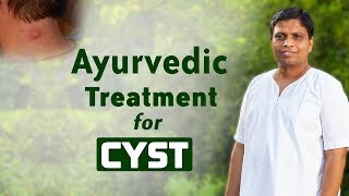 Ayurvedic Treatment for Cyst  Acharya Balkrishna [upl. by Lleneg]