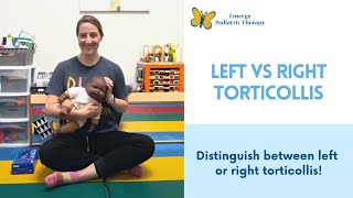 Left or Right Torticollis [upl. by Asha]