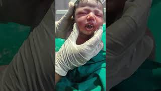 Baby massage therapy ytshorts shorts cute baby [upl. by Hakceber]