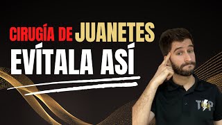 ❌Cirugía de juanetes Evítala con estos ejercicios para Hallux Valgus [upl. by Darrell641]