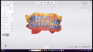 Reference Denture Intraoral Scans [upl. by Annaya]