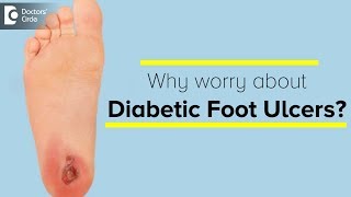 Diabetic Foot Ulcers amp its Management  Dr Sanjay Sharma  Doctors Circle [upl. by Biernat368]