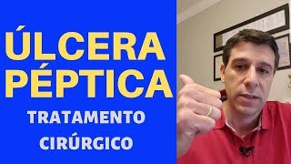 ÚLCERA PÉPTICA  TRATAMENTO CIRÚRGICO [upl. by Tamar535]