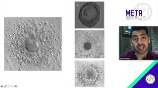 Oocyte factors to consider for embryo selection  Dr Keshav Malhotra [upl. by Hashimoto983]