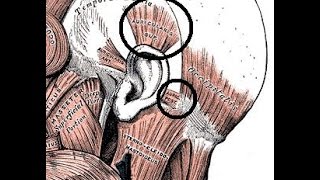 3KOPFLINKS\OBERFLÄCHLICH\OHR LINKS\MAURICULARIS SUPERIORLINKS [upl. by Einre]