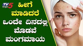 ಒಂದೇ ದಿನದಲ್ಲ ಮೊಡವೆ ಮಂಗಮಾಯ  Pimple Removal Tips  Kannada Health Tips  TV5 Kannada [upl. by Brest]