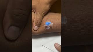 IV cannula insertiondocternursingmotivationviralvideoshortvideo [upl. by Rinna]