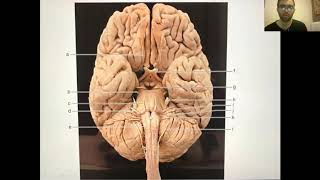 Facial Nerve Anatomy and its palsy [upl. by Yruoc]