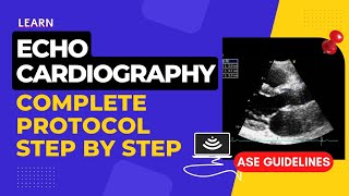 Echocardiography Standard Protocol  Step by Step  Complete Transthoracic Normal Echocardiogram [upl. by Faber]