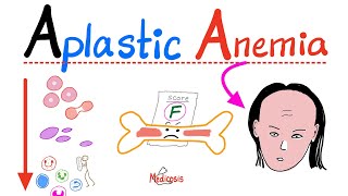 Aplastic Anemia  All you need to know  Definition Causes Symptoms Diagnosis amp Treatment [upl. by Lyckman]