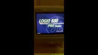 logiq 500 pro series encendido monitor error anterior [upl. by Lucky529]