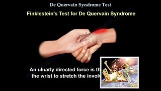 De Quervain Syndrome Test  Everything You Need To Know  Dr Nabil Ebraheim [upl. by Donn]