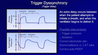 Pathologic Complications Mechanical Ventilation  Lecture 11 [upl. by Ninnahc]