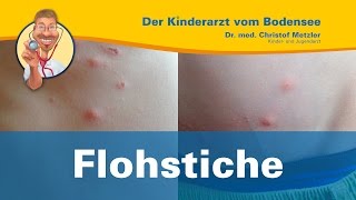 Flohstiche juckende Punkte in einer Reihe  Der Kinderarzt vom Bodensee [upl. by Lamoureux]