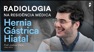 Hérnia Gástrica Hiatal  Radiologia na Residência Médica [upl. by Nodlehs591]