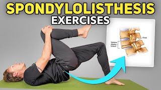 5 Exercises for Lumbar Spondylolisthesis [upl. by Shurlock]