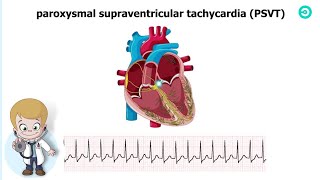 Types and ECG features of Supraventricular Tachycardia SVT [upl. by Archangel452]