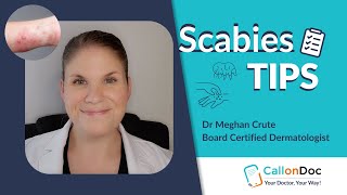 Dermatologist Recommended Scabies Tips [upl. by Norene]