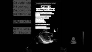 Effects of cardiogenic shock [upl. by Blaise]