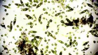 Mikroorganismen  microorganisms  Leben im Teich  life microcosmos 1080p Full HD [upl. by Mitchel]