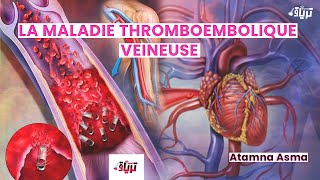 Physiopathologie La maladie thromboembolique veineuse Par Asma Atamna [upl. by Ia543]